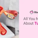 All You Need To Know About Tubectomy