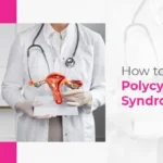 How to Deal With Polycystic Ovary Syndrome
